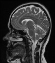 Sagittal Slice 7