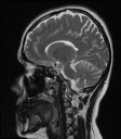 Sagittal Slice 8