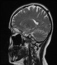 Sagittal Slice 9