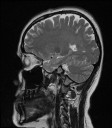 Sagittal Slice 2