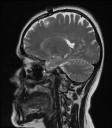 Sagittal Slice 3