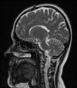 Sagittal Slice 4