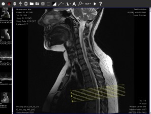 DICOM Viewer