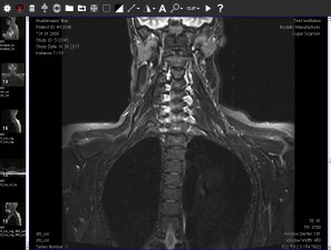 DICOM Viewer