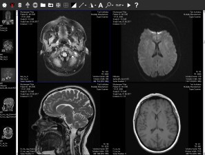 DICOM Viewer