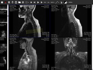 DICOM Viewer