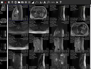 DICOM Viewer