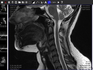 DICOM Viewer